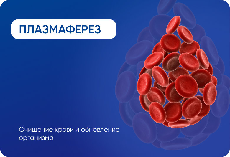 Плазмаферез